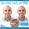 Instant Smile Complete Your Smile Tooth Replacement Kit